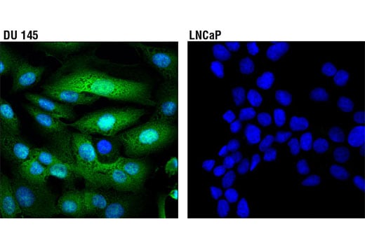 Immunofluorescence Image 1: UCHL1 (D3T2E) XP<sup>®</sup> Rabbit mAb