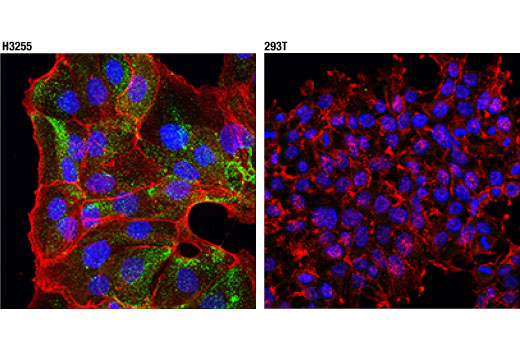 Immunofluorescence Image 1: Napsin A (D2G1Y) Rabbit mAb (IF Formulated)