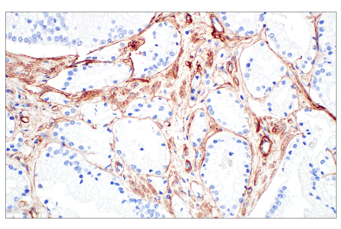 Immunohistochemistry Image 2: COL4A1 (E5M6R) Rabbit mAb (IHC Formulated)