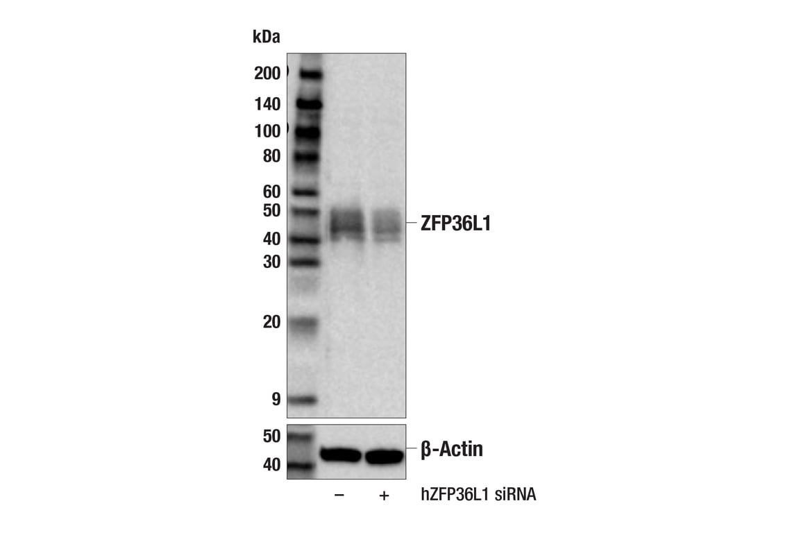 Western Blotting Image 2: ZFP36L1 (E6L6S) Rabbit mAb