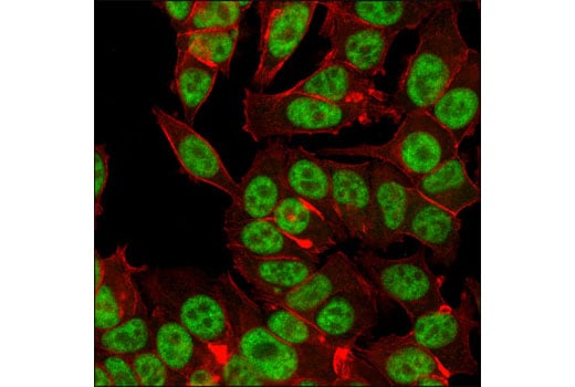 Immunofluorescence Image 1: HAUSP (D17C6) XP<sup>®</sup> Rabbit mAb