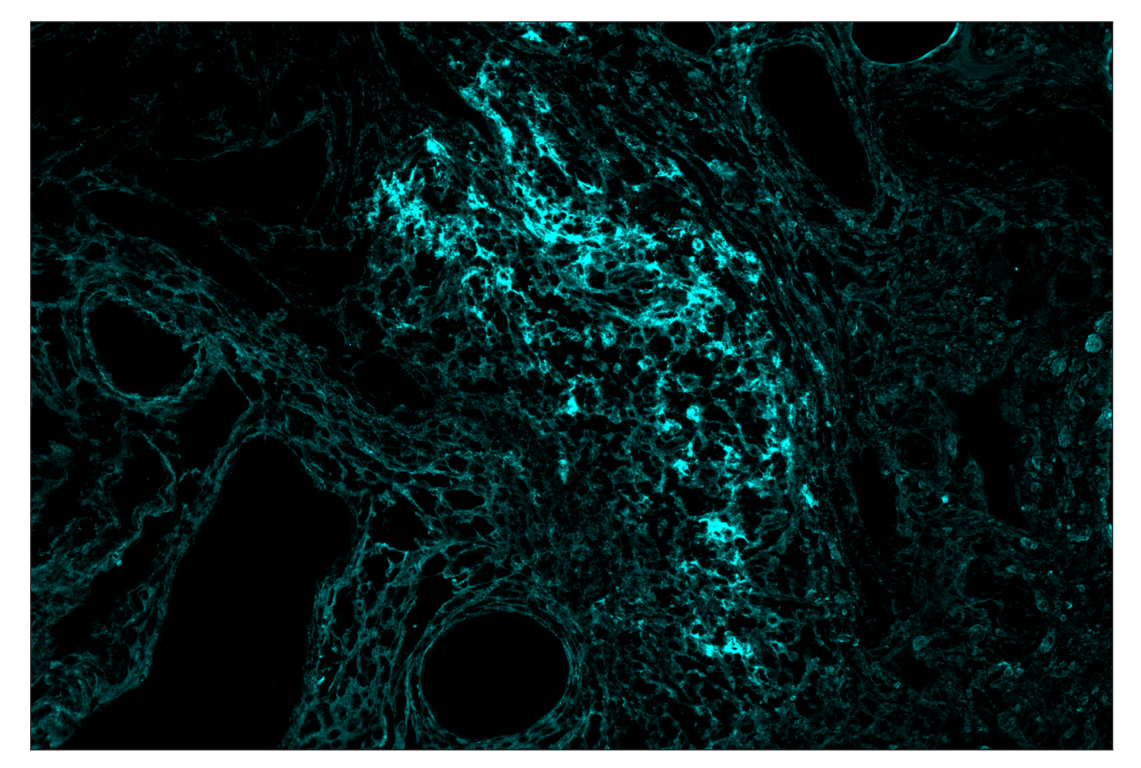 Immunohistochemistry Image 4: CD40 (D8W3N) & CO-0115-647 SignalStar<sup>™</sup> Oligo-Antibody Pair