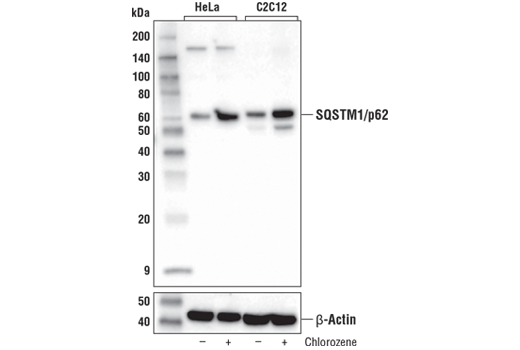 Western Blotting Image 4: SQSTM1/p62 (D1Q5S) Rabbit mAb