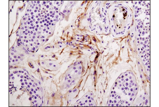 Immunohistochemistry Image 3: Integrin β3 (D7X3P) XP<sup>®</sup> Rabbit mAb