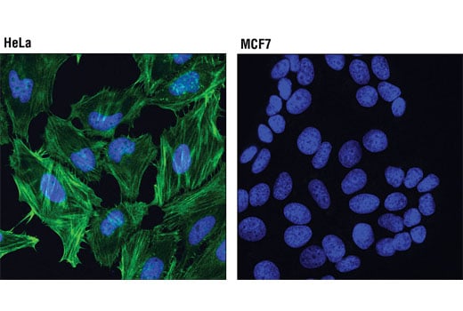 Immunofluorescence Image 1: Caldesmon-1 (D5C8D) XP<sup>®</sup> Rabbit mAb