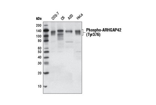 Western Blotting Image 2: Phospho-ARHGAP42 (Tyr376) (D45E9) Rabbit mAb