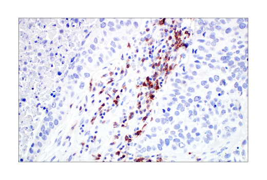 undefined Image 74: Human Exhausted CD8<sup>+</sup> T Cell IHC Antibody Sampler Kit