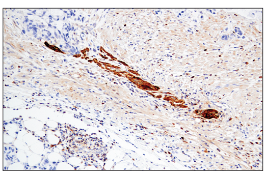 Immunohistochemistry Image 3: Enolase-2 (E2H9X) XP<sup>®</sup> Rabbit mAb