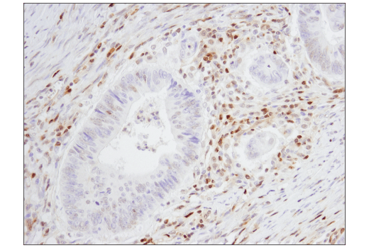 Immunohistochemistry Image 2: p27 Kip1 (SX53G8.5) Mouse mAb (IHC Formulated)