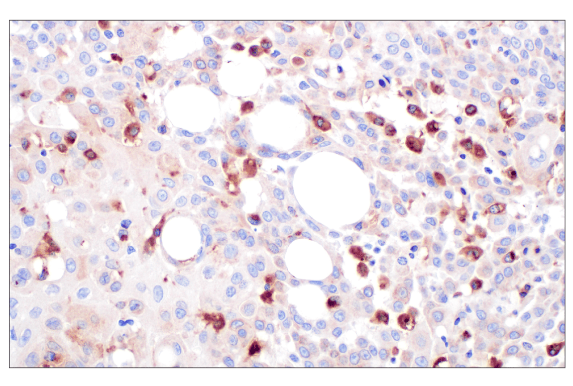 Immunohistochemistry Image 3: Cathepsin A (F8X9E) Rabbit mAb