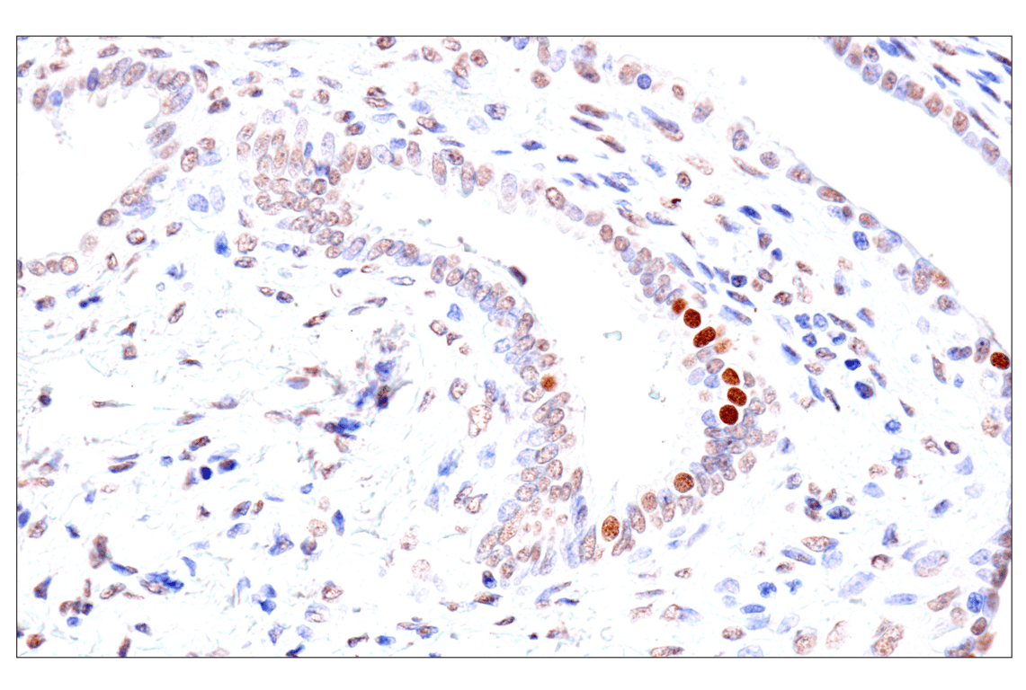 Immunohistochemistry Image 5: FoxA1/HNF3α (IHC578) Mouse mAb