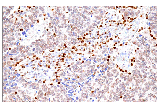 Immunohistochemistry Image 1: RUNX3/AML2 (E8D5W) XP<sup>®</sup> Rabbit mAb