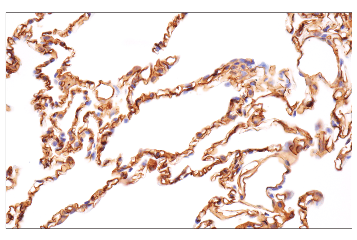 Immunohistochemistry Image 3: CD36 (D8L9T) Rabbit mAb (BSA and Azide Free)