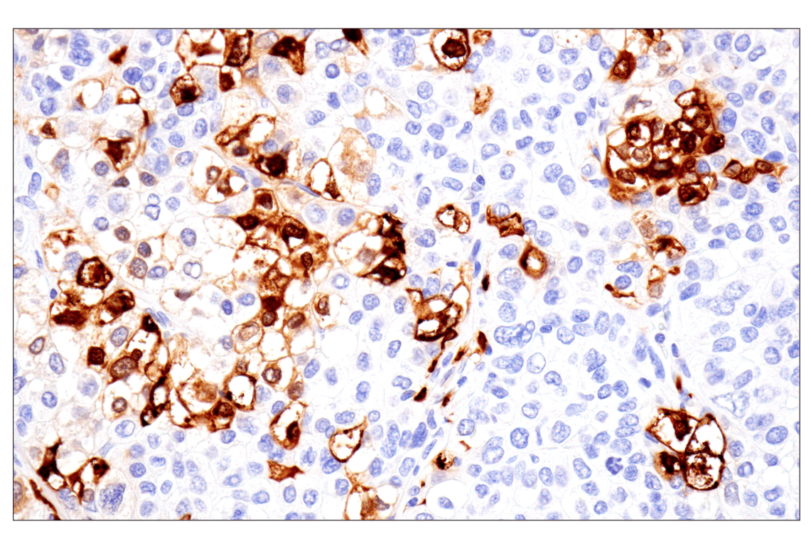 Immunohistochemistry Image 3: S100A8 (F4R2W) Rabbit mAb (BSA and Azide Free)