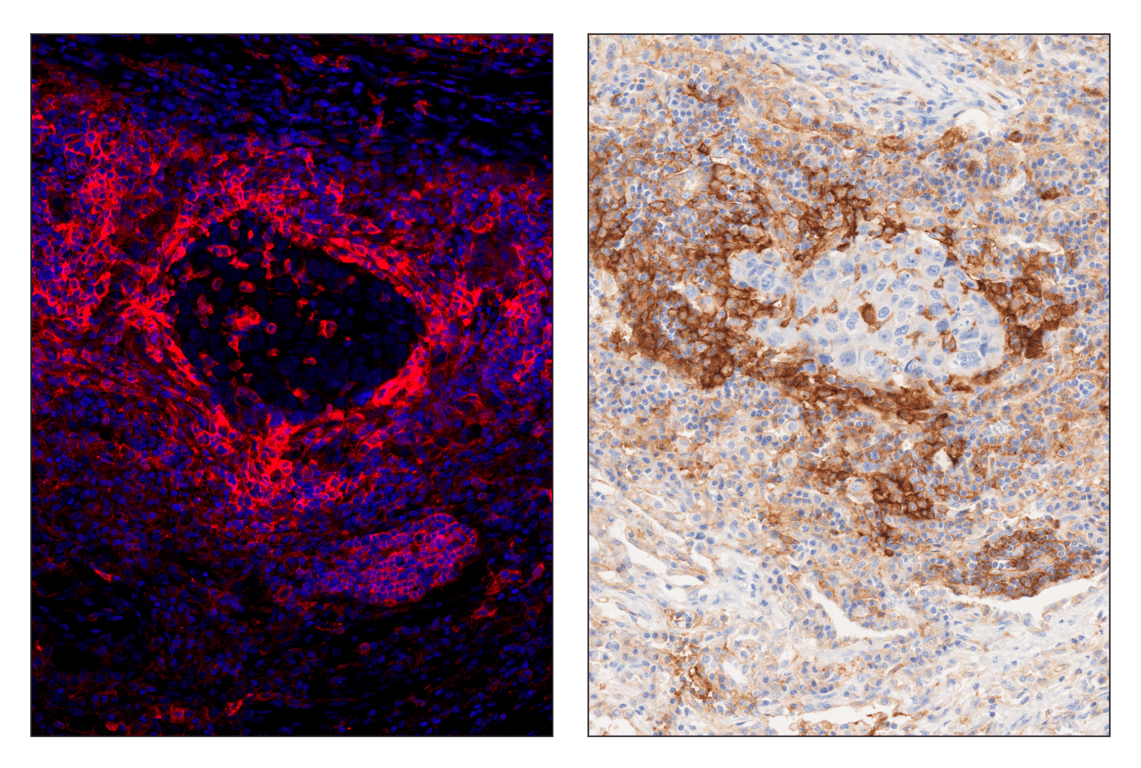 Immunohistochemistry Image 5: CD40 (D8W3N) & CO-0115-647 SignalStar<sup>™</sup> Oligo-Antibody Pair