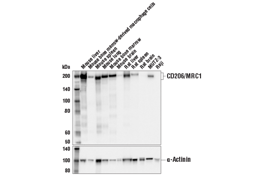 Western Blotting Image 1: CD206/MRC1 (E6T5J) XP<sup>®</sup> Rabbit mAb (BSA and Azide Free)