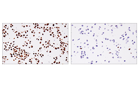 Immunohistochemistry Image 3: 53BP1 (E7N5D) XP<sup>®</sup> Rabbit mAb (BSA and Azide Free)