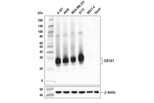 Western Blotting Image 1: CD151 (E4I9J) XP<sup>®</sup> Rabbit mAb