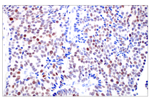 Immunohistochemistry Image 1: C/EBPβ (E2K1U) Rabbit mAb