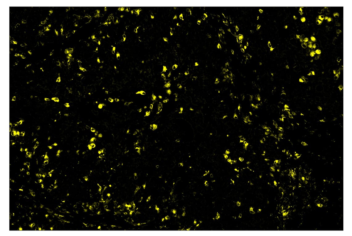 Immunohistochemistry Image 3: CD68 (D4B9C) & CO-0007-594 SignalStar<sup>™</sup> Oligo-Antibody Pair