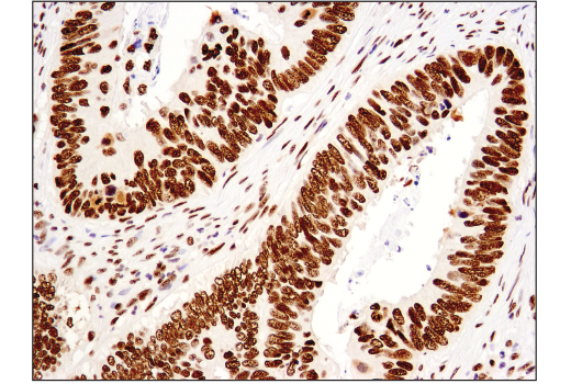 undefined Image 20: BAF Complex IHC Antibody Sampler Kit