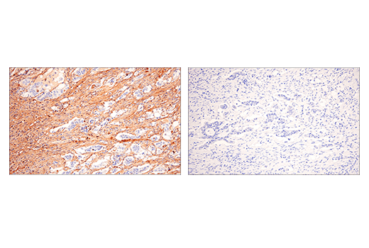 undefined Image 48: Extracellular Matrix Dynamics Antibody Sampler Kit