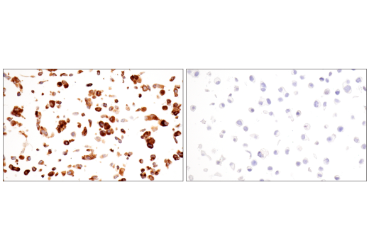 Immunohistochemistry Image 15: α-2-Macroglobulin (E6N7X) Rabbit mAb