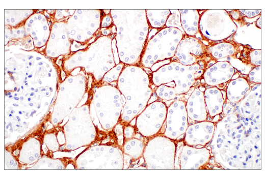 Immunohistochemistry Image 1: COL3A1 (E8D7R) XP<sup>®</sup> Rabbit mAb (BSA and Azide Free)