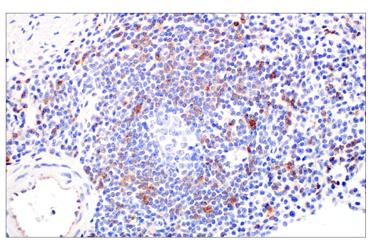 Immunohistochemistry Image 5: CD70 (E3Q1A) Rabbit mAb (BSA and Azide Free)