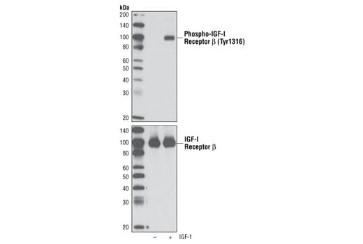 Western Blotting Image 1: Phospho-IGF-I Receptor β (Tyr1316) Antibody