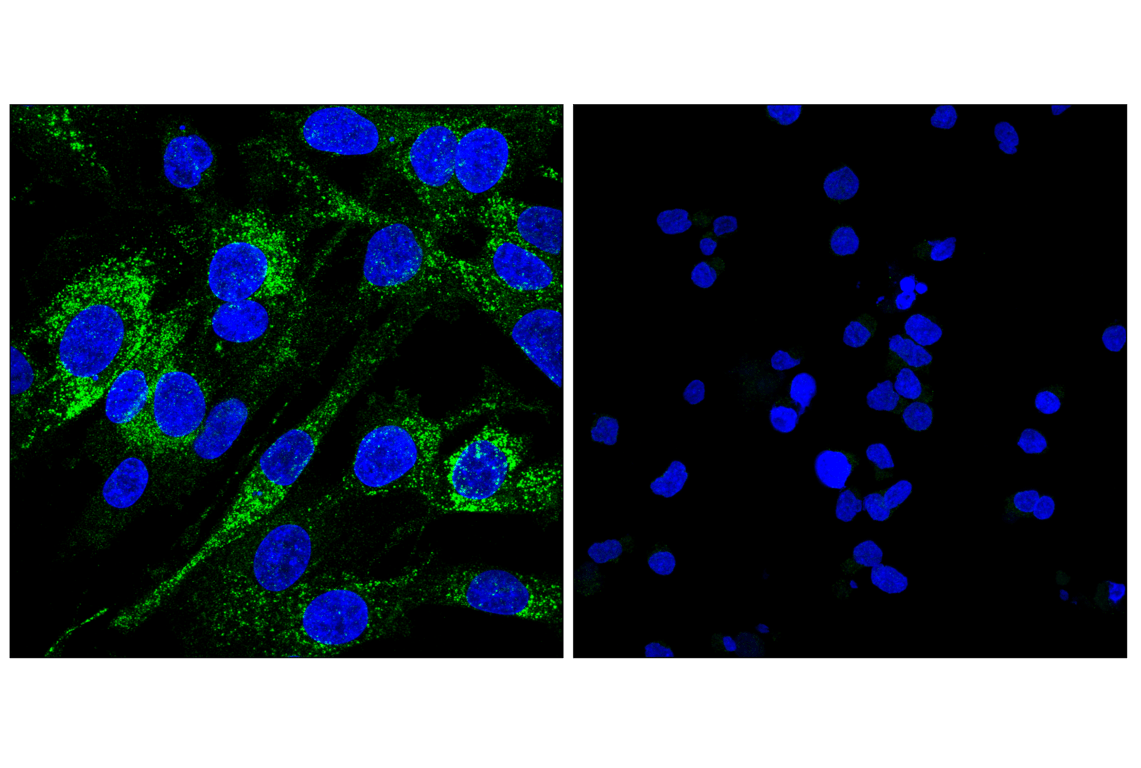 Immunofluorescence Image 1: GP130 (E6X8S) Rabbit mAb