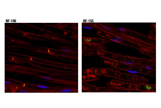 undefined Image 20: Demyelinating Disease Targets Antibody Sampler Kit