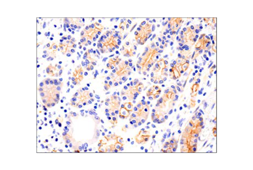 Immunohistochemistry Image 3: N-Cadherin (D4R1H) XP<sup>®</sup> Rabbit mAb
