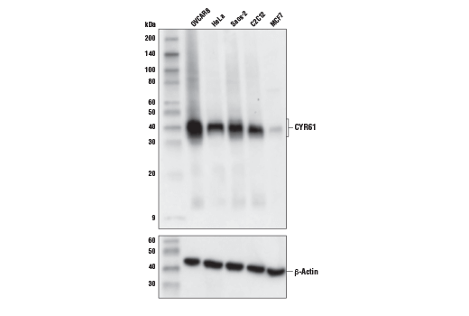 Western Blotting Image 1: CYR61 (E5W3H) Rabbit mAb