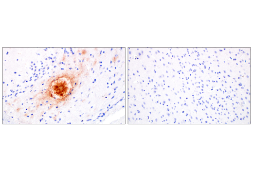 Immunohistochemistry Image 5: β-Amyloid (1-42) (E6D5M) Rabbit mAb (BSA and Azide Free)