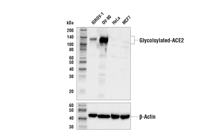 Western Blotting Image 1: ACE2 Antibody