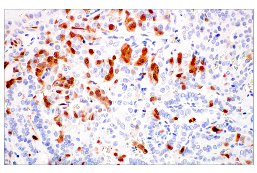 Immunohistochemistry Image 1: p16 INK4A (BC42) Mouse mAb