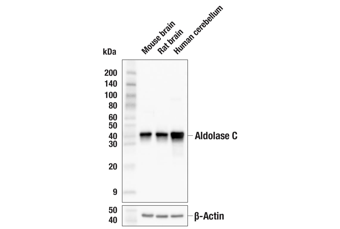 Western Blotting Image 1: Aldolase C (E7I4X) Rabbit mAb