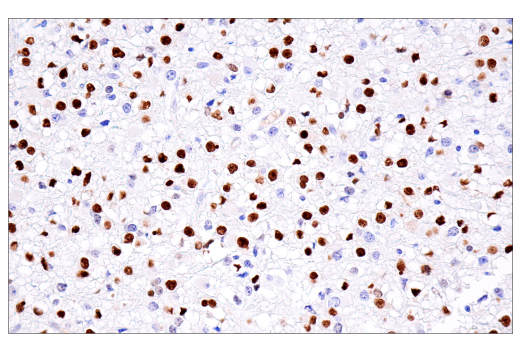 Immunohistochemistry Image 1: Olig2 (E6G6Q) XP<sup>®</sup> Rabbit mAb (BSA and Azide Free)