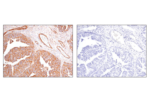 Immunohistochemistry Image 2: α-Actinin 4 (D7U5A) Rabbit mAb 