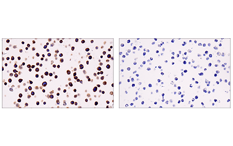 Immunohistochemistry Image 1: LAT (E3U6J) XP<sup>®</sup> Rabbit mAb (BSA and Azide Free)