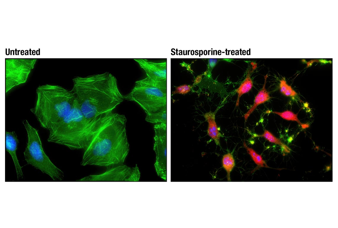 Immunofluorescence Image 1: Cleaved Caspase-3 (Asp175) (D3E9) Rabbit mAb (Alexa Fluor<sup>®</sup> 594 Conjugate)