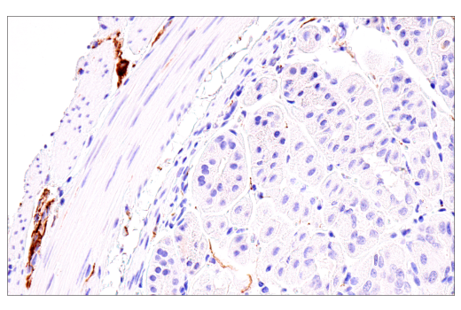 Immunohistochemistry Image 6: Neurofilament-M (E7L2T) Rabbit mAb