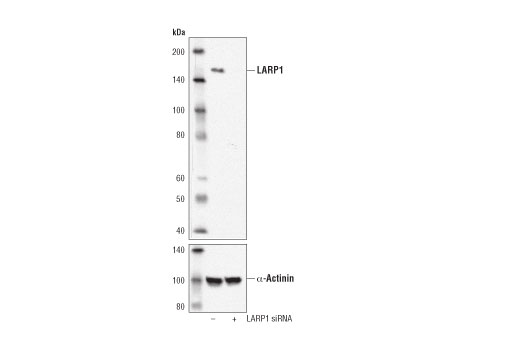 Western Blotting Image 2: LARP1 (D8J4F) Rabbit mAb