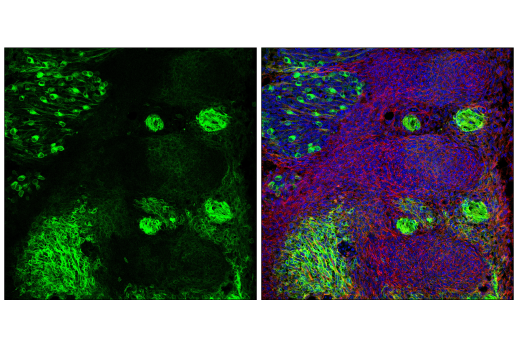 Immunofluorescence Image 2: p75NTR (D4B3) XP<sup>®</sup> Rabbit mAb