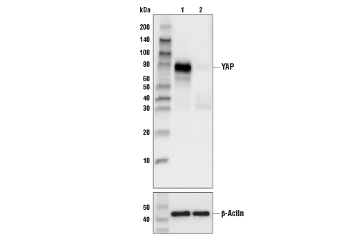 Western Blotting Image 1: YAP (D8H1X) XP<sup>®</sup> Rabbit mAb