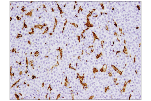 undefined Image 48: Human Reactive M1 vs M2 Macrophage IHC Antibody Sampler Kit