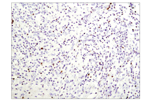 Immunohistochemistry Image 2: T-bet/TBX21 (D6N8B) XP<sup>®</sup> Rabbit mAb (BSA and Azide Free)