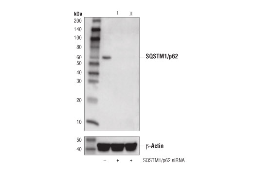 undefined Image 34: Human Reactive Cell Death and Autophagy Antibody Sampler Kit