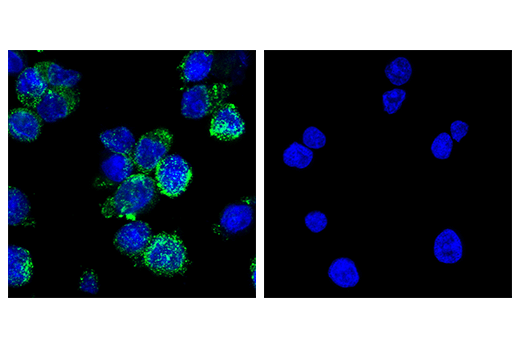undefined Image 54: Human Reactive M1 vs M2 Macrophage IHC Antibody Sampler Kit